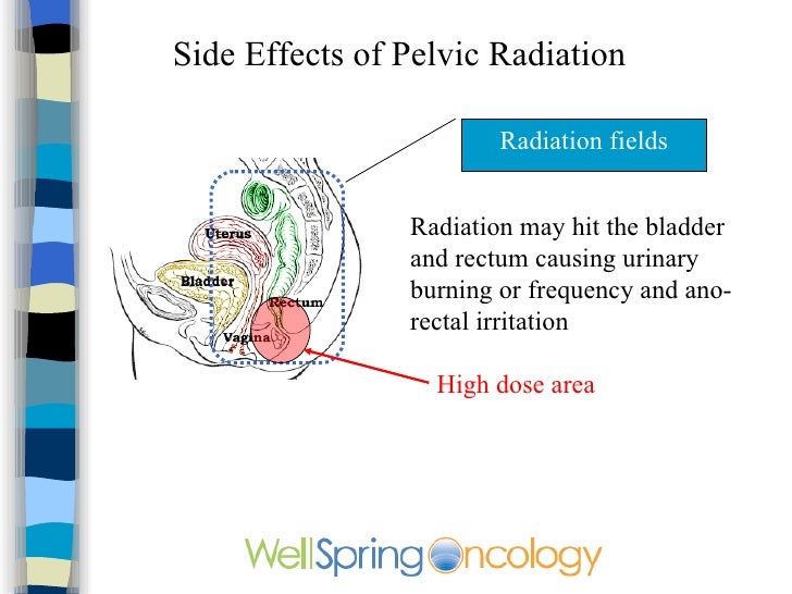 Radiation treatment anal Punished with a fist fuck